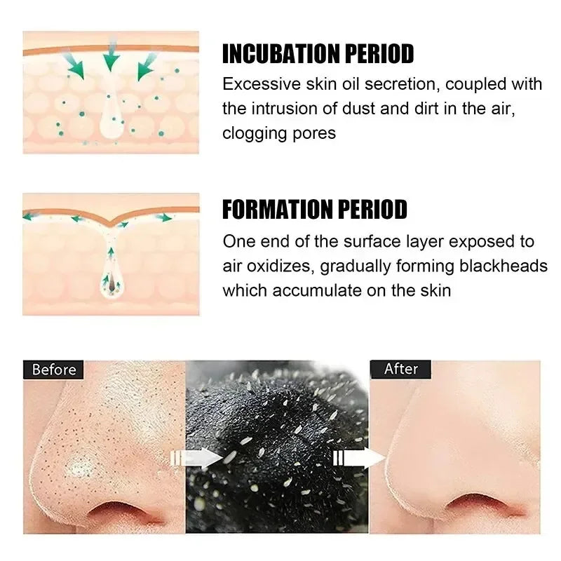 SUAKE Blackhead Removal Nose Strips For Pore Cleansing