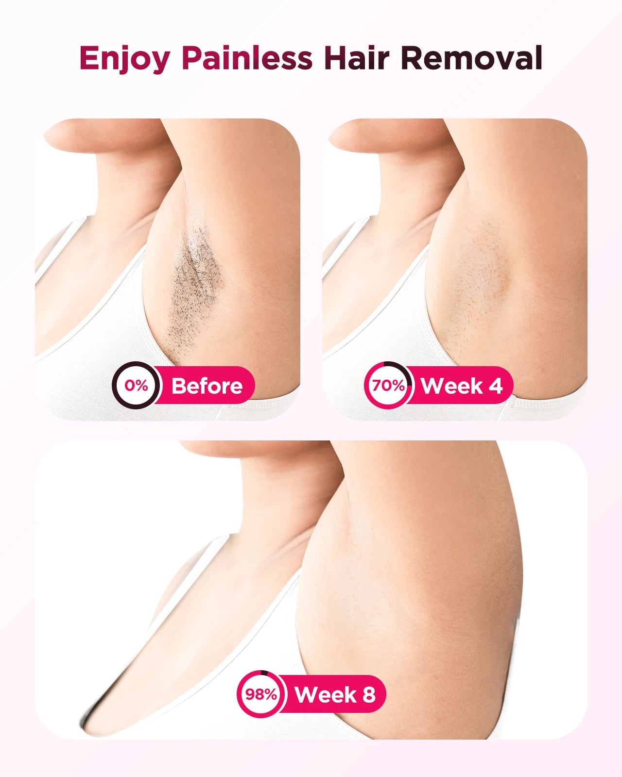 Totmizby IPL Laser Epilator Hair Removal For Body And Facial