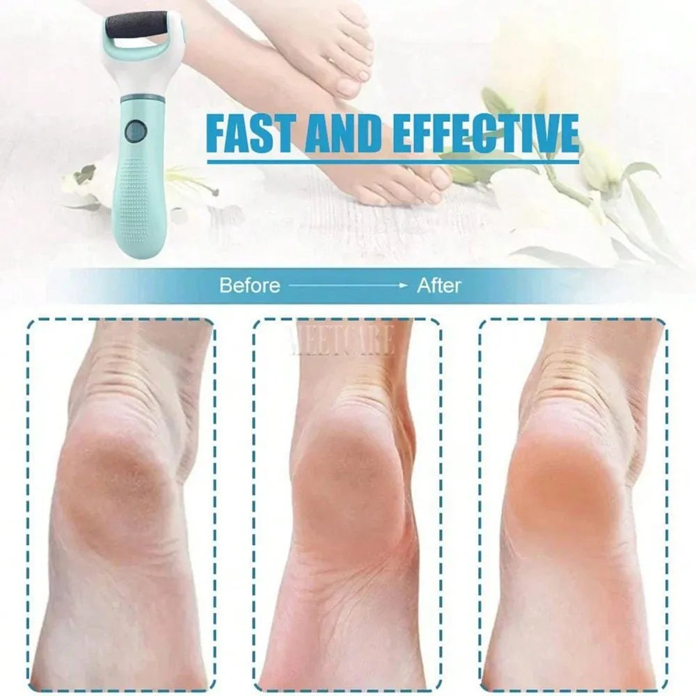 Foot File Callus Remover Tool For Dead Skin Care Daily